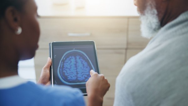 New MRI brain scan predicts Alzheimer's risk years before symptoms develop