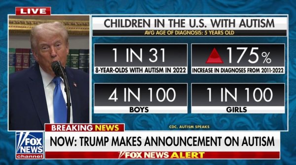 Autism spectrum in adults has commonly overlooked symptoms, experts warn Autism spectrum in adults has commonly overlooked symptoms, experts warn