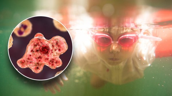 Teen dies from ‘brain-eating amoeba’ just days after young girl succumbs to same rare infection Teen dies from ‘brain-eating amoeba’ just days after young girl succumbs to same rare infection