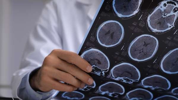 7 new dementia risk factors revealed — including one millions struggle with 7 new dementia risk factors revealed — including one millions struggle with