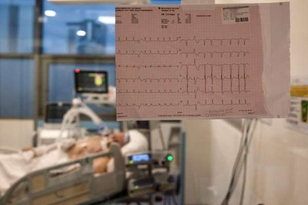 Study finds money worries increase speed of heart aging